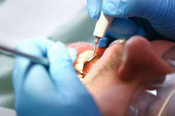 Best Knocked-Out Tooth Emergency  in Cumming, GA