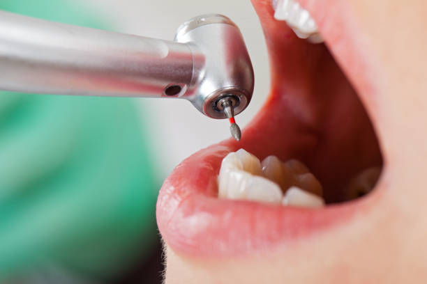 Best Tooth Infection Emergency Dentist  in Cumming, GA